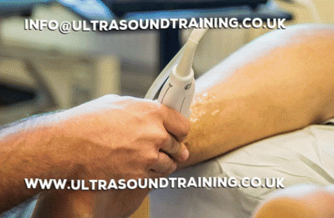 Get Ultrasound scans in London UK. High-frequency sound waves. Book an Ultrasound Online or call us Today. Visit https://bit.ly/2LuyRmf