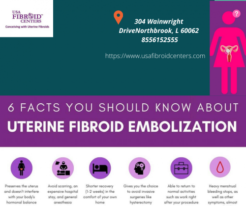 Uterine-Fibroid-Embolization.png