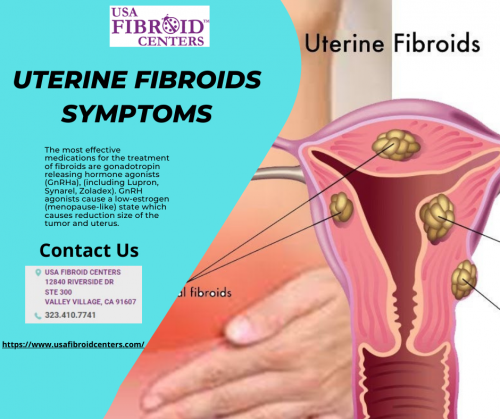 Uterine-Fibroids-Symptoms-1.png