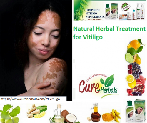 Vitiligo-Natural-Treatments--How-to-Cure-Vitiligo-by-Using-Natural-Vitiligo-Oil.png