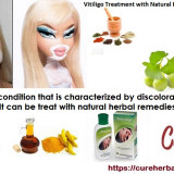 Vitiligo-and-its-natural-Herbal-Treatment