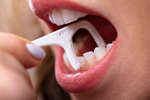 What-are-the-Benefits-of-Flossing.jpg