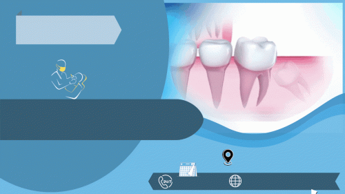 Do you need an Emergency Dentist in Houston? We are open 7 days a week. Same day appointments and treatment are always available. Call now! For more details please visit https://www.emergencydentalcenter.com/
