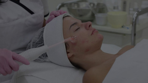 We provide the best acne treatment for dry sensitive skin at Theskincarecompanyipswich.co.uk. Our acne treatment Ipswich Suffolk is a 45 min treatment, and costs just £49.

Click here:- https://theskincarecompanyipswich.co.uk/acne-treatment-ipswich-suffolk/