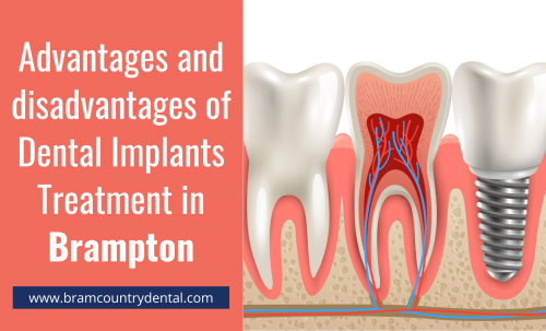 dental-Implants-advantages-and-disadvantages.png