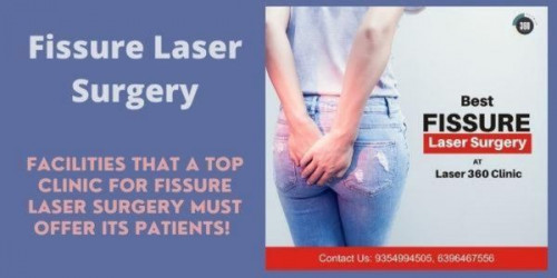 The Affordable cost is yet another feature that makes Laser360Clinic a prominent place for fissure laser surgery in Noida. 
https://laser360clinic.com/facilities-that-a-top-clinic-for-fissure-laser-surgery-must-offer-its-patients/