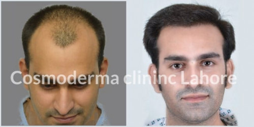 hair-2-1.jpg