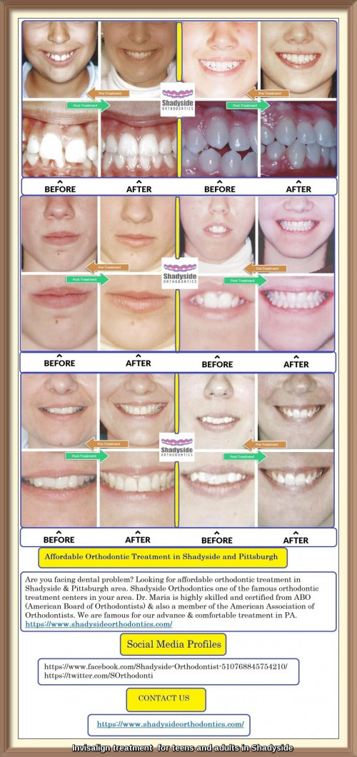 Are you facing dental problem? Looking for affordable orthodontic treatment in Shadyside & Pittsburgh area. Shadyside Orthodontics one of the famous orthodontic treatment centers in your area. Dr. Maria is highly skilled and certified from ABO (American Board of Orthodontists) & also a member of the American Association of Orthodontists. We are famous for our advance & comfortable treatment in PA.
https://www.shadysideorthodontics.com/