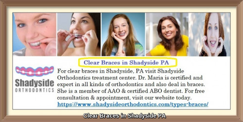 For clear braces in Shadyside, PA visit Shadyside Orthodontics treatment center. Dr. Maria is certified and expert in all kinds of orthodontics and also deal in braces. She is a member of AAO & certified ABO dentist. For free consultation & appointment, visit our website today.  For more information visit our website.
https://www.shadysideorthodontics.com/types-braces/