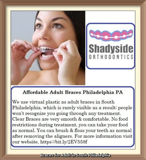 We use virtual plastic as adult braces in South Philadelphia, which is rarely visible as a result; people won’t recognize you going through any treatment. Clear Braces are very smooth & comfortable. No food restrictions during treatment, you can take your food as normal. You can brush & floss your teeth as normal after removing the aligners. For more information information visit our website, https://bit.ly/2EV558f