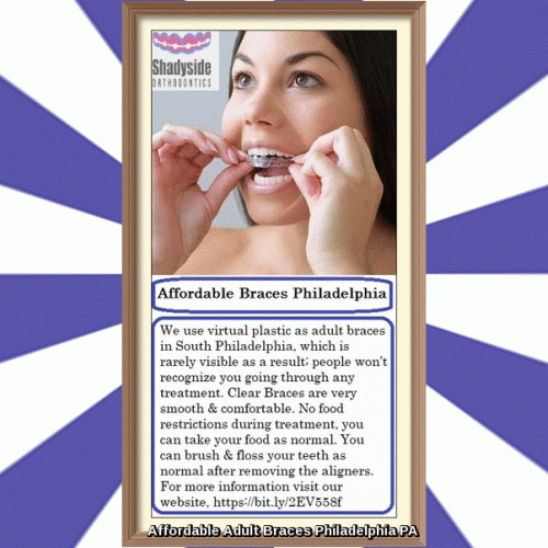 We use virtual plastic as adult braces in South Philadelphia, which is rarely visible as a result; people won’t recognize you going through any treatment. Clear Braces are very smooth & comfortable. No food restrictions during treatment, you can take your food as normal. You can brush & floss your teeth as normal after removing the aligners. For more information visit our website, https://bit.ly/2EV558f