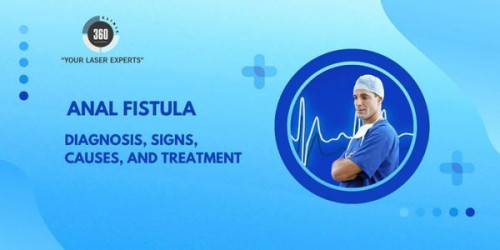 The anal fistula is now easy to have a simple and effective treatment of laser. Get the surgery done soon before it’s too late.
https://laser360clinic.com/anal-fistula-diagnosis-signs-causes-and-treatment/