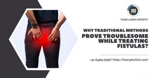 But laser treatment is much safer than this as it involves a small beam in the process of laser treatment for fistula, and healing the wound at a faster pace.
https://laser360clinic.com/why-traditional-methods-prove-troublesome-while-treating-fistulas/