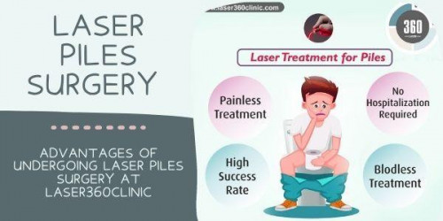 All the facilities and more are some basic reasons that have made Laser360Clinic the best clinic for laser piles surgery in Delhi.
https://laser360clinic.com/advantages-of-undergoing-laser-piles-surgery-at-laser360clinic/