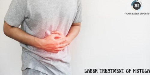 The most effective Laser Treatment of Fistulas is provided by qualified medical professionals who have a focus on using lasers to treat disease.
https://laser360clinic.com/laser-fistula-treatment/