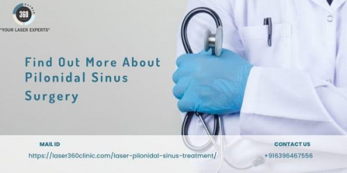 There is no need to worry about pilonidal sinus, as laser surgery is there to help you. Visit the leading laser 360 clinic.
https://laser360clinic.com/find-out-more-about-pilonidal-sinus-surgery/
