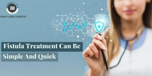 An affordable laser treatment is quite convenient for the sufferers as the treatment for fistula is traditionally pretty expensive.
https://laser360clinic.com/fistula-treatment-can-be-simple-and-quick/