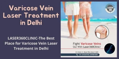 Laser360Clinic has the best team of laser surgeons and support staff that have in-depth knowledge and expertise in the varicose veins treatment.
https://laser360clinic.com/laser360clinic-the-best-place-for-varicose-vein-laser-treatment-in-delhi/